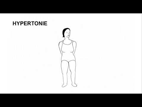Video: Hypertonie 1 Grad: Symptome Und Behandlung, Medikamente, Prävention