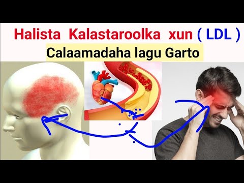 Halista Kolastaroolka Calaamadaha Cuntooyinka Dhibaatooyinka Iyo Xalka With Dr Timajilac