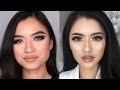 MY BOTOX + FILLER STORY (+COST) Bahasa Indonesia