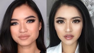 MY BOTOX + FILLER STORY (+COST) Bahasa Indonesia