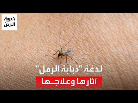 ظن أنها حشرة عادية لكنها لم تكن كذلك قصة أردني عانى من ذبابة الرمل