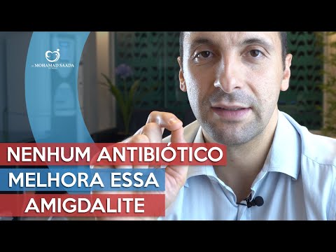 Nenhum Antibiótico Melhora Essa Amigdalite