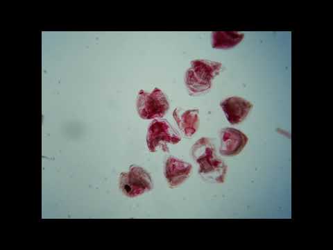 Video: Vad används glochidium till?