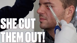 DOCTOR ASKS WIFE TO REMOVE STITCHES FROM HUSBAND'S EYE! EYE SEWN SHUT | STITCHES REMOVED AT HOME