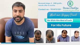 Best hair transplant in India
