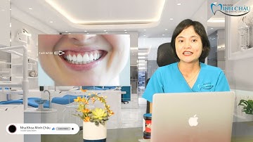 Cười Hở Lợi | Nguyên Nhân Và Cách Điều Trị ?