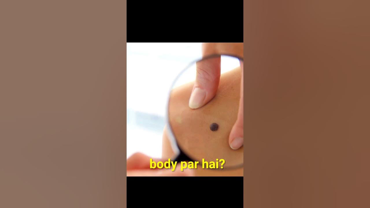 what-causes-moles-to-suddenly-appear-animation-youtube
