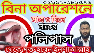 Nasal Polyps Treatment।Short।পলিপাসের চিকিৎসা।