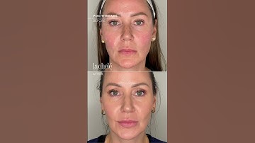 PDO Threads: What They