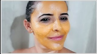 INICIANDO TRATAMENTO DAS MANCHAS COM AÃ‡AFRÃƒO E CREME NÃVEA (Dica de uma inscrita)