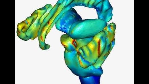 Sub-cortical and brainstem modulation by tDCS - High-Resolution Computational Model of tDCS