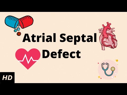 Video: Atrial Septal Defect - Symptoms, Treatment, Forms, Stages, Diagnosis