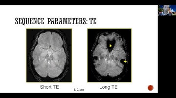 Learn fMRI W05 (Monti, UCLA) 02 Preprocessing: Intro (pt2)