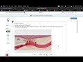 HW Ch 33 The Lymphatic and Immune Systems McGraw Hill