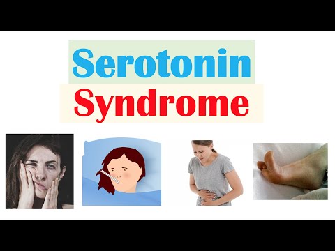 Video: Potrei sapere se ho la sindrome serotoninergica?