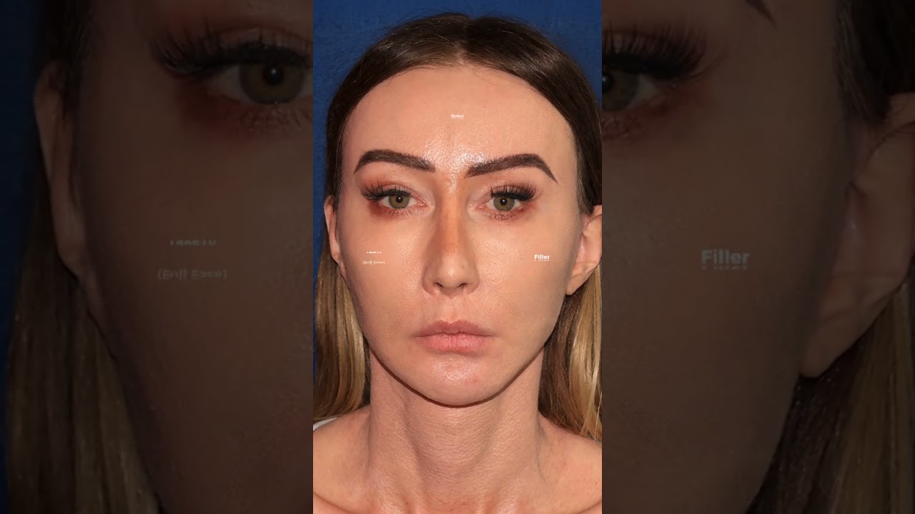 Banner for How to age backwards? #Filler #Drfabi #Take10