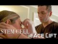 Look  feel younger with a stem cell face lift  dr moustafa mourad  mourad nyc