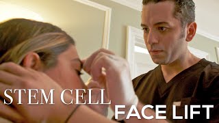 Look & Feel Younger With a Stem Cell Face Lift | Dr. Moustafa Mourad | Mourad NYC