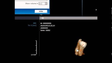 ONDEMAND - SEGMENTAZIONE 3D - METODO A