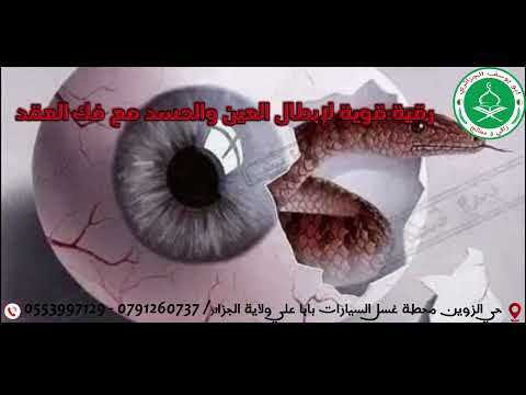 رقية قوية لإبطال العين والحسد مع فك العقد 