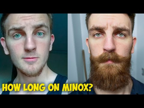 How Long Should you Use Minoxidil for Beard Growth? Scalp ...