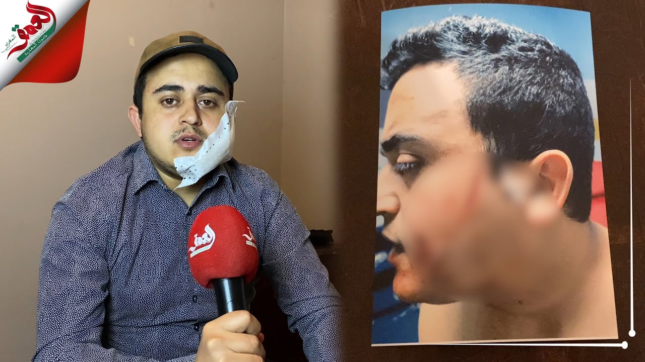 دكتور جامعي يتعرض للاعتــ.داء بالحرم الجامعي بوجدة قبيل اجتيازه مبارة التعليم العالي