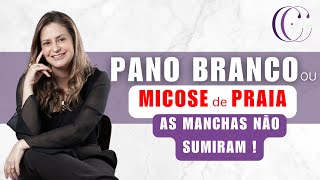 PANO BRANCO ou 'MICOSE de PRAIA':  tratei e as manchas não sumiram?