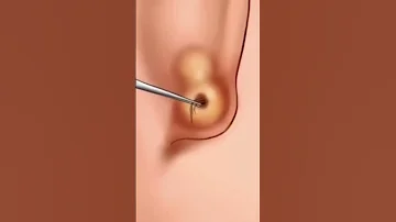 ASMR Ear Ring Piercing Cleaning Treatment Animation Asmr Shorts Viral 