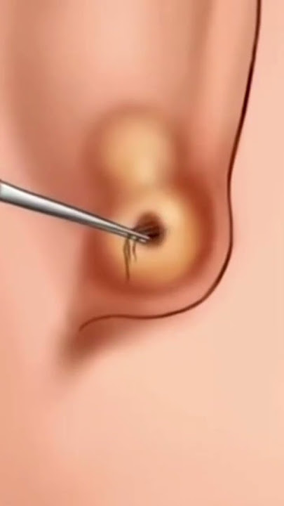 ASMR Ear Ring 💍 Piercing Cleaning Treatment Animation #asmr #shorts #viral