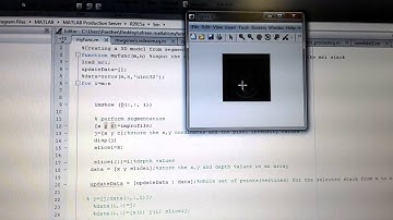 Creating a 3D model from segmented data points from an MRI dataset.