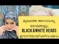 Diy milk peel off mask to remove blackheads and whiteheads and unwanted hairmy passion vlog