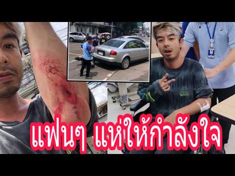 กวาง AB Normal ประสบอุบัติเหตุ แต่โชคดีแค่แขนถลอก เพราะสาเหตุนี้!?
