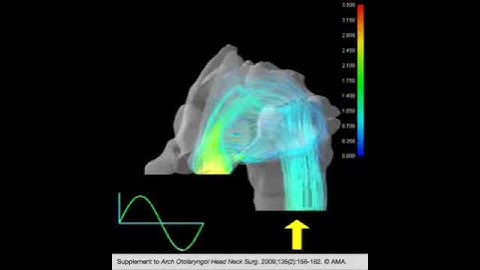 Dynamic Streamline Simulation of Nasal Flow Part 2
