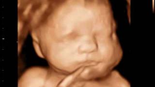 3D  Ultrasound  Baby 33 weeks