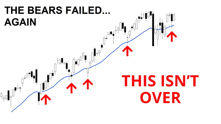Technical Analysis of Stocks: SPY / QQQ / NVDA / TSLA / AMD / PLTR / SOFI / UNH