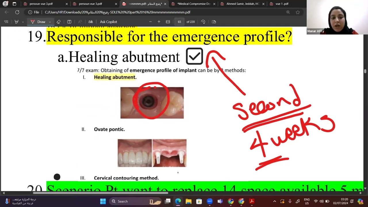 امبلانت رفيع المقام 16 مهم#برومترك #برومترك_السعوديه #برومترك_قطر #برومترك_دبي #برومترك_اسنان #sdle