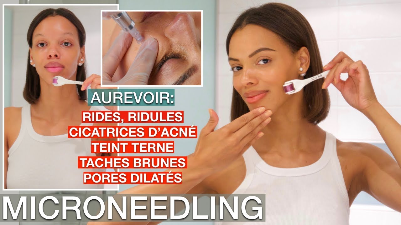 Microneedling à la Maison | Guide Complet - YouTube