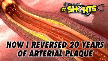 #SHORTS: How I Reversed 20 years of Arterial Plaque