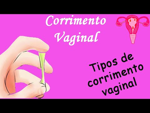 Vídeo: Descarga Após O Período: Cor, Consistência E Causas