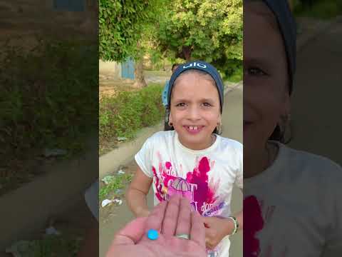 الطفل اكل الشكوبن