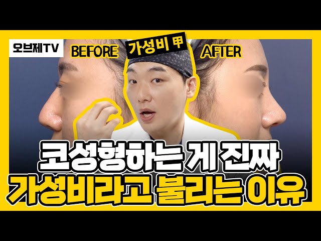 코성형 이유, 진짜 여기에 있다! 코성형하는 게 진짜 가성비라고 불리는 이유 | 코부지 이경묵 원장) 코성형전후, 코성형후기, 오브제성형외과