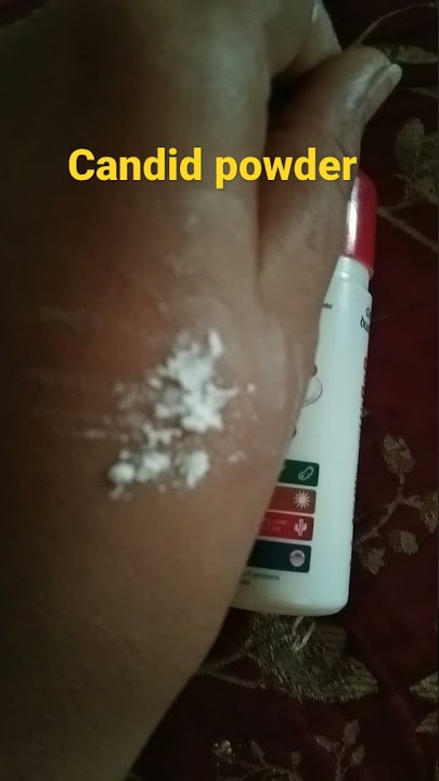 candid powder fugal infection prickly heat expect skin solution  price 80 #shorts