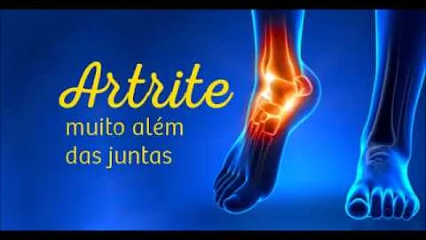 O que quer dizer artrite reumatoide soro positivo?