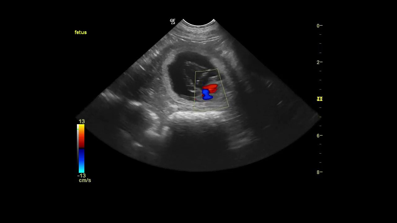 Puppy Fetal Heart Rate Monitor