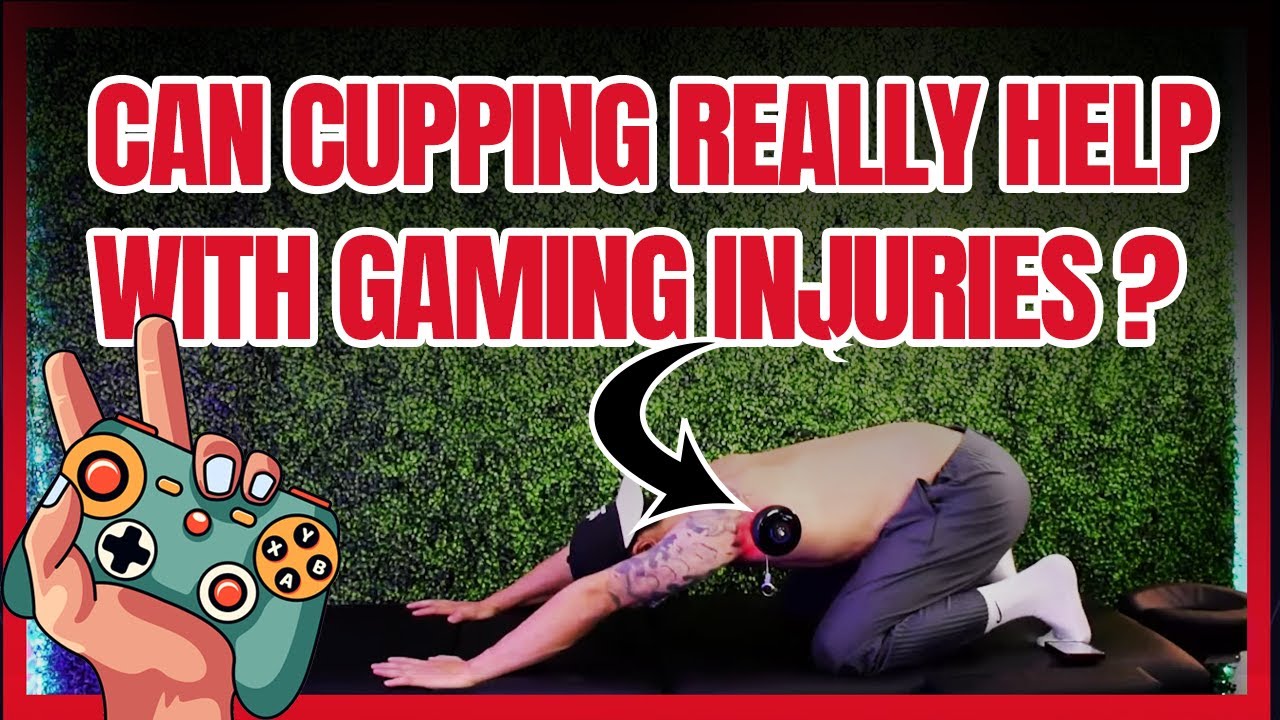 Can Cupping Really Help With Gaming Injuries ?  | 1HP