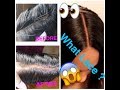 How To PROPERLY Bleach The Knots On Your Lace Closure/Frontal