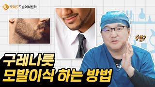 ⭐남성성을 강조하는 구레나룻! 어떻게 이식하는 걸까요?⭐｜모발이식 FAQ｜로미모 모발이식센터｜강민호 원장