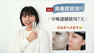 SK-II 青春露實測！！！連續擦7天皮膚有變好嗎？