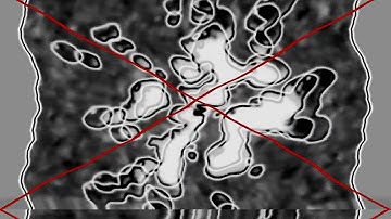 TVN Csupo Effects Round 1 vs KlaalK CsuusC and Everyone (Round 2 Logoduel Effects)