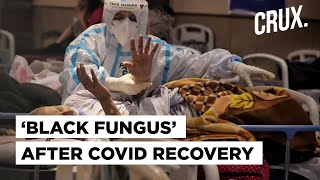 What Is Mucormycosis Or Black Fungus That Can Cause Blindness or Even Death After Covid-19